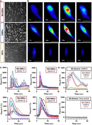 Activation and Contraction of Human “Vascular” Smooth Muscle Cells Grown From Circulating Blood Progenitors